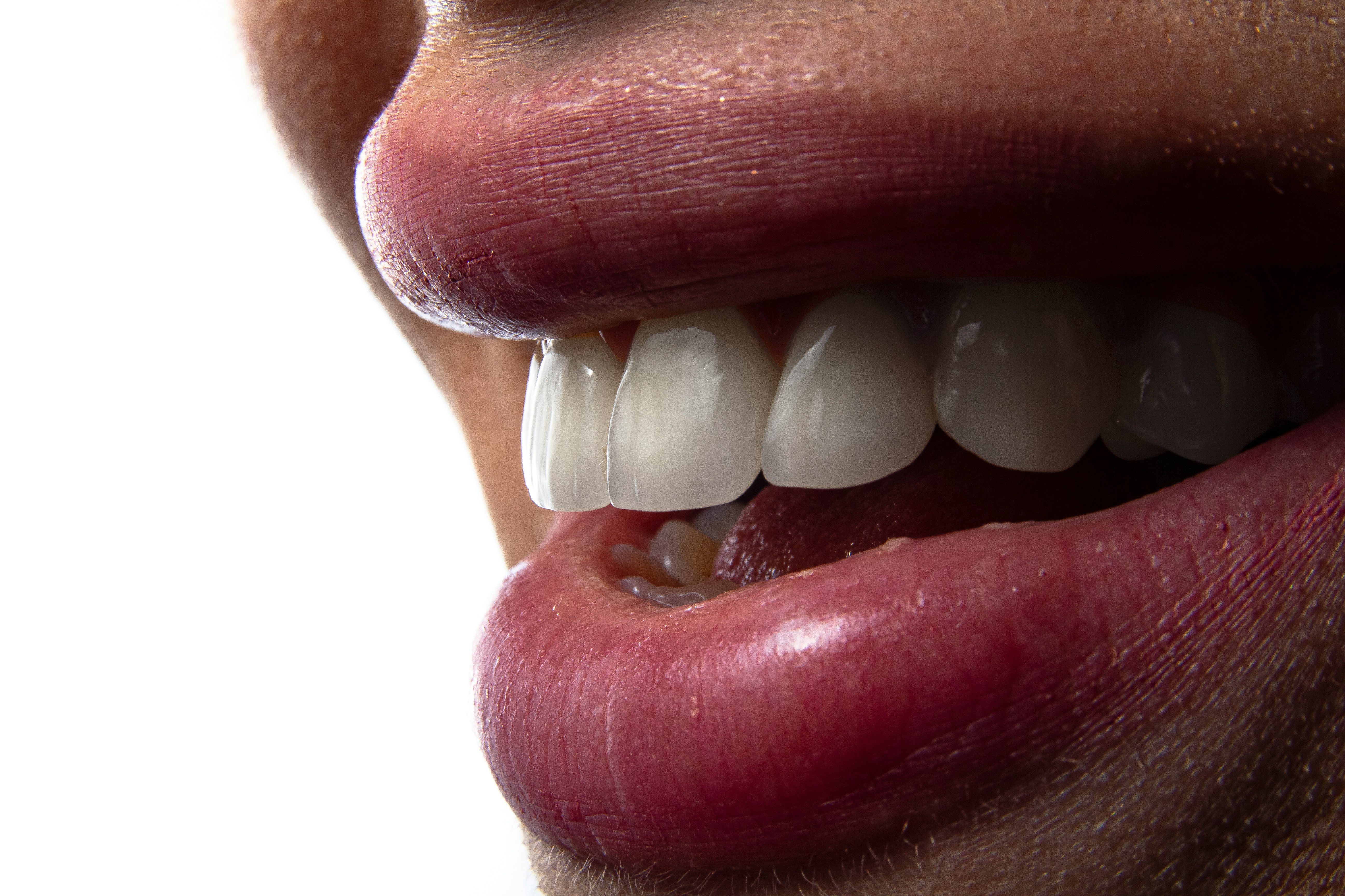 Healthy tooth enamel close-up